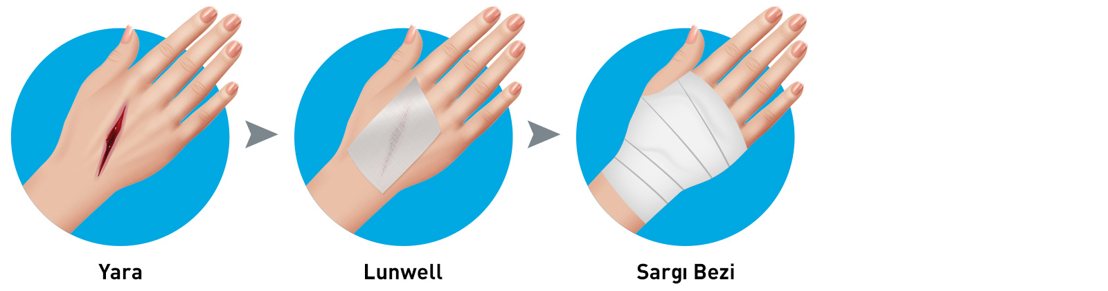 Gümüşlü Yara Bakım Örtüsü Kullanım Şekli