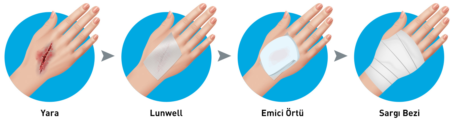 Gümüşlü Yara Bakım Örtüsü Kullanım Şekli
